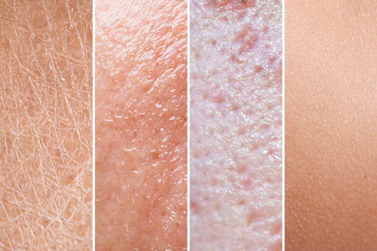 Verschiedene Hauttypen