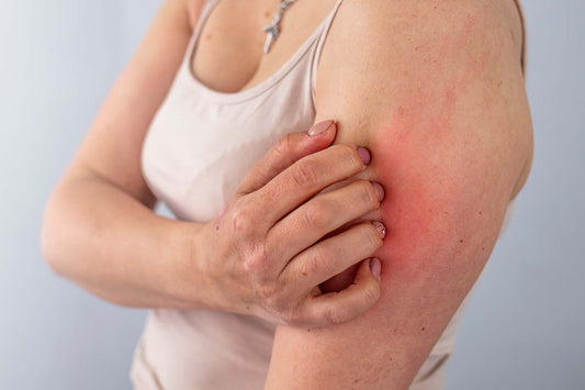 Frau mit Neurodermitis kratzt sich am Arm