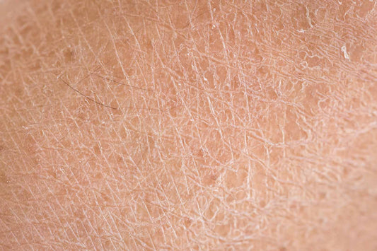 Vergrößertes Bild von trockener Haut